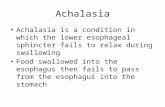 Achalasia Achalasia is a condition in which the lower esophageal sphincter fails to relax during swallowing Food swallowed into the esophagus then fails.