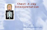 Chest X-ray Interpretation Dr C. Lokubalasooriya.