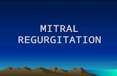 MITRAL REGURGITATION. 2D ASSESSMENT LOOK CAREFULLY AT THE MITRAL VALVE APPARATUS.