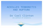 ACHILLES TENDONITIS AND RUPTURE Dr Carl Clinton (no conflict of interests)