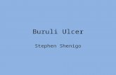 Buruli Ulcer Stephen Shenigo. What do you know? .