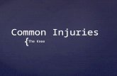 { Common Injuries The Knee. Patellar Fractures  MOI:  Rapid forced knee flexion (landing from a jump)  Blunt trauma (Tonya Harding)  Risk of complete.