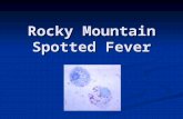 Rocky Mountain Spotted Fever. Rocky Mountain Spotted Fever: First recognized in 1896 in the Snake River Valley of Idaho and was originally called "black.