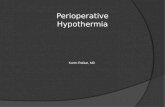 Perioperative Hypothermia Karim Rafaat, MD. Introduction  The human thermoregulatory system usually maintains core body temperature within 0.2 ℃ of 37.