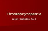 Thrombocytopenia Jason Corbeill PA-C. Platelet facts Chunks of cytoplasmic fragments of a megakaryocyte (in bone marrow) Chunks of cytoplasmic fragments.