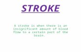 STROKE A stroke is when there is an insignificant amount of blood flow to a certain part of the brain.