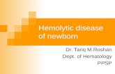 Hemolytic disease of newborn Dr. Tariq M.Roshan Dept. of Hematology PPSP.