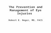 The Prevention and Management of Eye Injuries Robert E. Neger, MD, FACS.