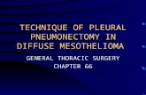 TECHNIQUE OF PLEURAL PNEUMONECTOMY IN DIFFUSE MESOTHELIOMA GENERAL THORACIC SURGERY CHAPTER 66.