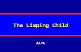 The Limping Child AAPA. Definition Limp = Asymmetry Joint - Range of motion Bone - Deformity Pain Control.
