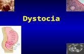Dystocia. 2 Breastfeeding 3 What is lactogenesis? Lactogenesis is a series of cellular changes by which mammary epithelial cells differentiate and mature.