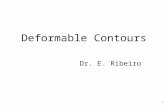 Deformable Contours 1 Dr. E. Ribeiro. Classical Methods 2 Thresholding Edge detection An image of blood vessel Slide by: Chunming Li, Vanderbilt University.
