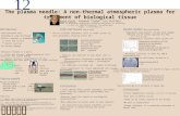 1212 /mhj Introduction The plasma needle: A non-thermal atmospheric plasma for treatment of biological tissue Ingrid Kieft, Raymond Sladek, Eva Stoffels.