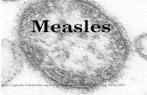 Measles http://upload.wikimedia.org/wikipedia/commons/6/62/Measles_virus.JPG.