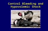 Control Bleeding and Hypovolemic Shock. Core SkillsControl Bleeding2 Introduction n Review methods of controlling bleeding n Hemorrhage control save lives.