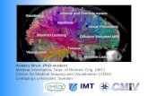 Manifold Learning – from Brain Visualization to Advanced Image Processing Anders Brun, PhD student Medical Informatics, Dept. of Biomed. Eng. (IMT) Center.