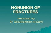 NONUNION OF FRACTURES Presented by: Dr. AbdulRahman Al-Garni.