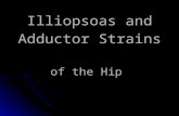 Illiopsoas and Adductor Strains of the Hip. Anatomy of the Hip.
