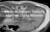 Medical Images Texture Analysis Using Waveles. Why Texture Analysis? Method for differentiation between normal and abnormal tissue. Contrast between malignant.
