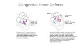 Congenital Heart Defects. Electrical Conduction System Sino Atrial (SA) Node – sup/post rt atrium Atrial Ventricular (AV) Node – inf rt atrium AV.