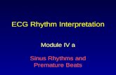 ECG Rhythm Interpretation Module IV a Sinus Rhythms and Premature Beats.