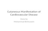 Cutaneous Manifestation of Cardiovascular Disease Done by Mohammad Binhussein.