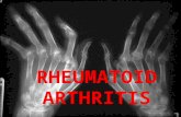 RHEUMATOID ARTHRITIS. Chronic multisystem disease of unknown cause Characteristic features: Persistent inflammatory synovitis Involves peripheral joints.