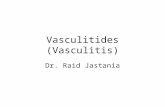 Vasculitides (Vasculitis) Dr. Raid Jastania. Vasculitis Inflammation of the walls of the vessels Causes of inflammation: –Infectious, physical, chemical,