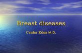 Breast diseases Csaba Kósa M.D.. Symptoms of benign breast disease Breast pain (mastalgia) Breast pain (mastalgia) –Cyclical –Primary non-cyclical Musculoskeletal.