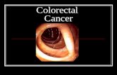 Colorectal Cancer. Summary: Content of Colorectal Cancer Tutorial Statistics Anatomy of the gastrointestinal tract Colorectal cancer Cancer progression