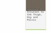 Anatomy & Injuries to the Thigh, Hip and Pelvis. General Information about the pelvis  This area of body is strong and stable  Great demand placed on.