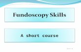 A short course 11-5-13 v5. Why do a fundus exam? To enable detection of the three most common causes of blindness early enough to prevent blindness: 1.