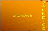 JAUNDICE It is yellowish discoloration of Skin, mucous membranes, sclera Due to excess plasma bilirubin Is not a disease but rather a sign that can occur.