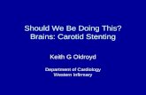 Should We Be Doing This? Brains: Carotid Stenting Keith G Oldroyd Department of Cardiology Western Infirmary.