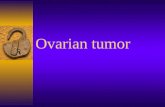 Ovarian tumor Ovarian tumor is one of the most common tumors of the female generative system. Little progress has been made in identifying precursory.