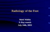 Radiology of the Foot Mark Wahba X-Ray rounds July 24th, 2003.