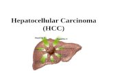 Hepatocellular Carcinoma (HCC). Different types of cancer can behave very differently. For example, lung cancer and breast cancer are very different diseases.