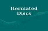 Herniated Discs. Objectives You will be able to identify the anatomy of the lower backYou will be able to identify the anatomy of the lower back You will.