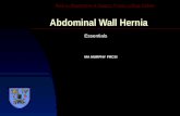 Abdominal Wall Hernia Essentials MA MURPHY FRCSI Back to Department of Surgery Trinity College Dublin.