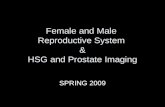 Female and Male Reproductive System & HSG and Prostate Imaging SPRING 2009.