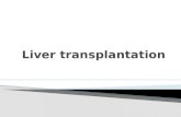 Is the replacement of a diseased liver with a healthy liver allograft.  Used technique is orthotopic transplantation, in which the native liver is.