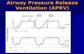Airway Pressure Release Ventilation (APRV) Objectives Provide the definition and names for APRV Provide the definition and names for APRV Explain the.