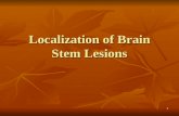 1 Localization of Brain Stem Lesions. 2 Anatomy of the Brain Stem Part of the brain that extends from: The rostral plane of the Superior Colliculus To.