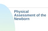 Physical Assessment of the Newborn. Assessment n Two fundamental types of exams u Periodic comprehensive exam u Problem specific exam.