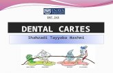 Shahzadi Tayyaba Hashmi DNT 243. DENTAL CARIES Definition: Also known as tooth decay or a cavity It is defined as an infection which is bacterial in origin.