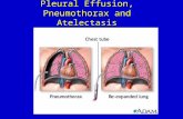 Pleural Effusion, Pneumothorax and Atelectasis. Mosby items and derived items © 2009 by Mosby, Inc., an affiliate of Elsevier Inc. 2 The Pleural Space.
