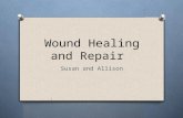 Wound Healing and Repair Susan and Allison. Define the following cell types, give examples: O Labile O Stable O Permanent Continuously dividing -Epithelia.