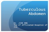 Tuberculous Abdomen Dr. JIAN ANG The 2 nd Affiliated Hospital of ZJU.