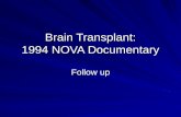Brain Transplant: 1994 NOVA Documentary Follow up.