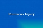 What is a Meniscus? The menisci are crescent-shaped fibrocartilaginous discs located between the distal femoral condyles and proximal tibial plateau.